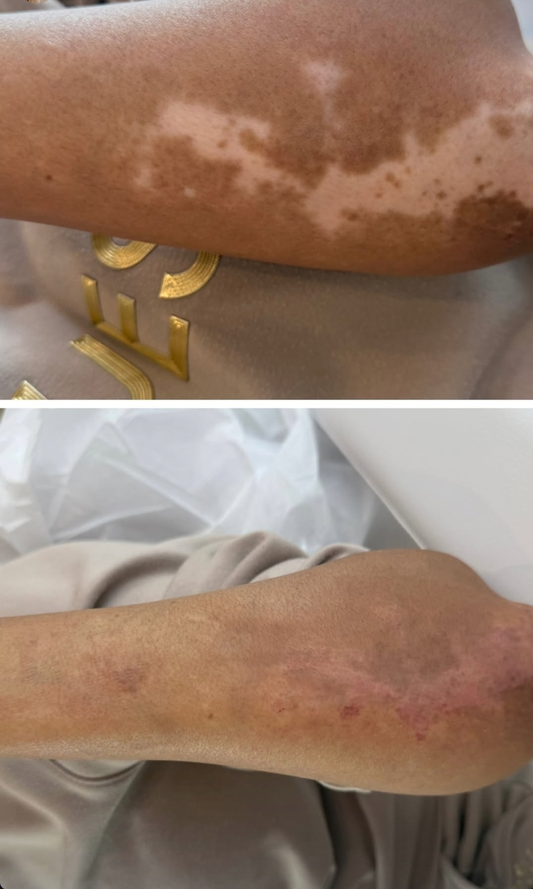 Paramedical Tattooing
