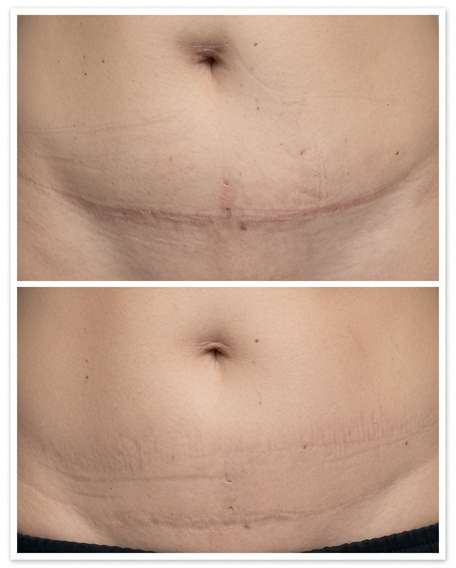 Skin transformation result
