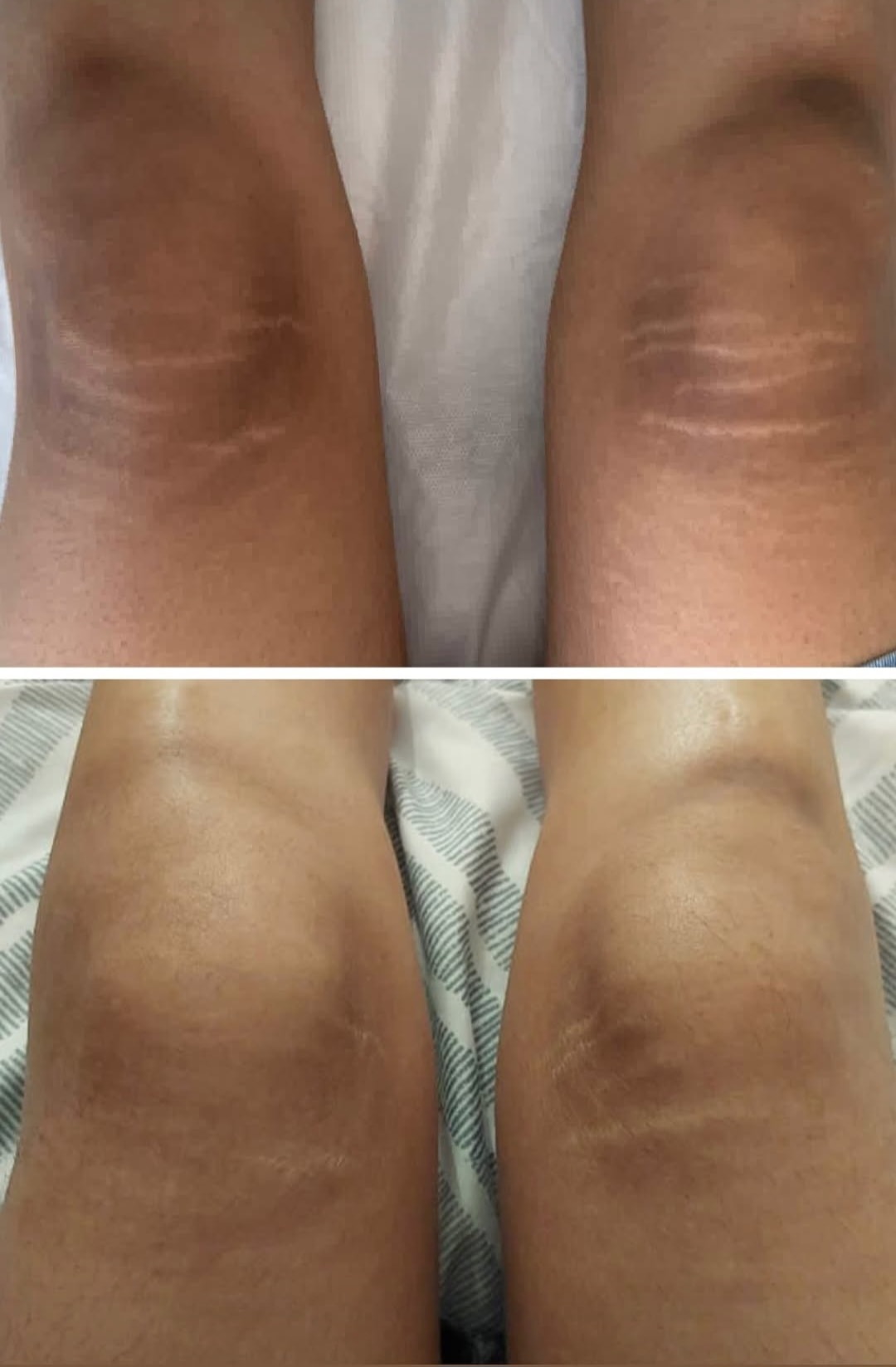 Skin transformation result